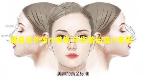 隆鼻后外伤ct表现 外伤脑出血ct表现